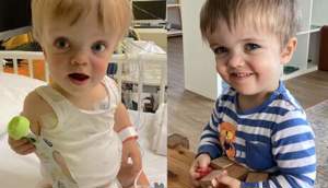 داروی جدید کوتاه‌‌قامتی کودکان  TransCon CNP در انتظار تصمیم نهایی FDA