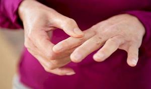 چگونه از بیماری آرتریت روماتوئید با خبر شویم بهداشت نیوز