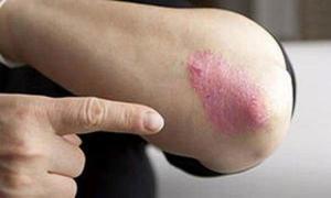 بهداشت نیوز