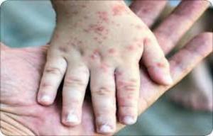 بهداشت نیوز