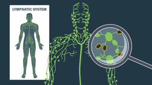 What Happens When Cancer Spreads to the Lymph Nodes?