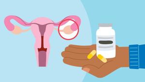 Berberine for PCOS: Benefits and Risks