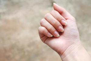 The Health Warnings Hidden in Your Fingernails