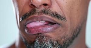 Sour Taste in Your Mouth? Here Are the 9 Most Common Causes