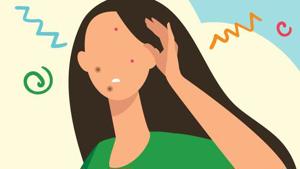 Can Pimple Patches Make a Zit Go Away?