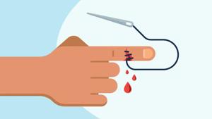 Here’s How To Tell if Your Cut Needs Stitches