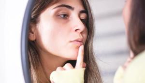 Canker Sores vs. Cold Sores: Know the Difference