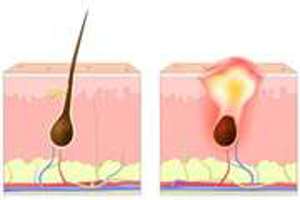 معاونت بهداشت
