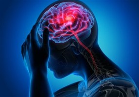 ابتلای 1.4 میلیون ایرانی به صرع/ میگرن شایع‌ترین نوع سردرد