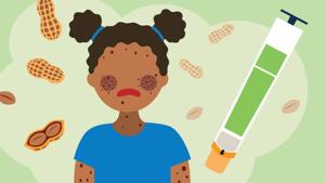 Learn the Signs of a Peanut Allergy Emergency