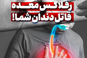 مهر