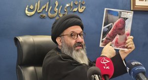 حدود ۱۲۵۰ بیمار «ای بی» در کشور شناسایی شده اند مهر